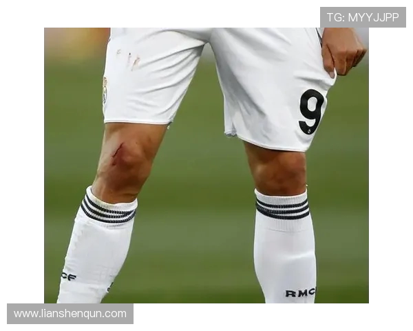 西甲联赛C罗流血：C罗在西甲联赛中的经典时刻与受伤事件